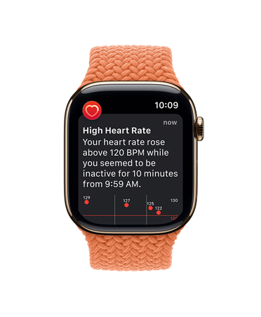 Apple Watch Series 11, titanium case gold color, High heart rate notification, Braided Solo Loop, turmeric color
