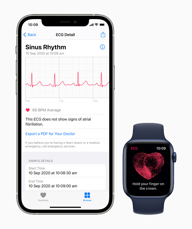 The ECG app displaying the sinus rhythm classification on Apple Watch Series 6.