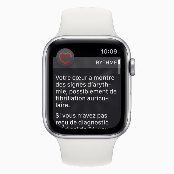 Cadran d’Apple Watch montrant une notification d’arythmie.