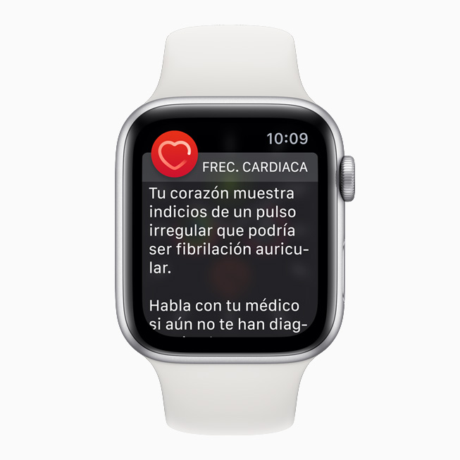 Imagen de la app ECG con una notificación de ritmo sinusal en el Apple Watch. 