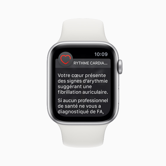 Cadran d’Apple Watch avec la notification d’arythmie.