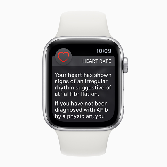 Apple Watch face with irregular heart rhythm notification.