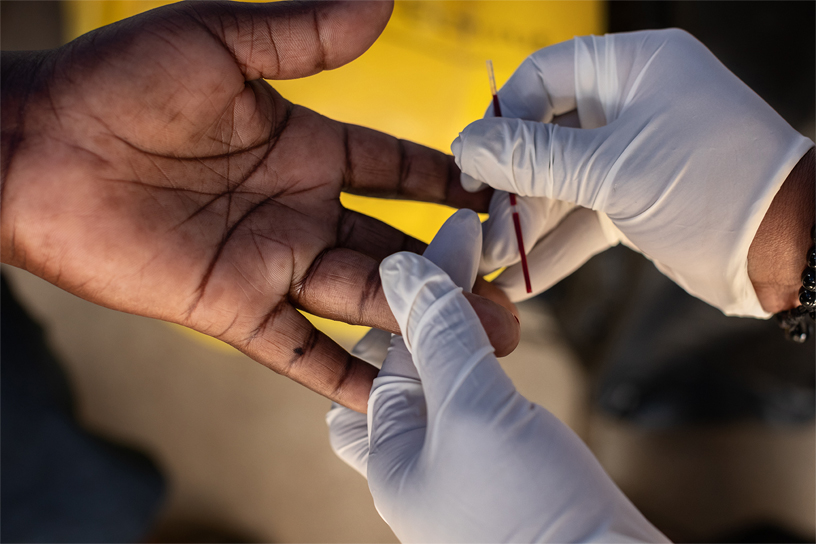 A sterilised needle is used to prick the finger for a blood sample.
