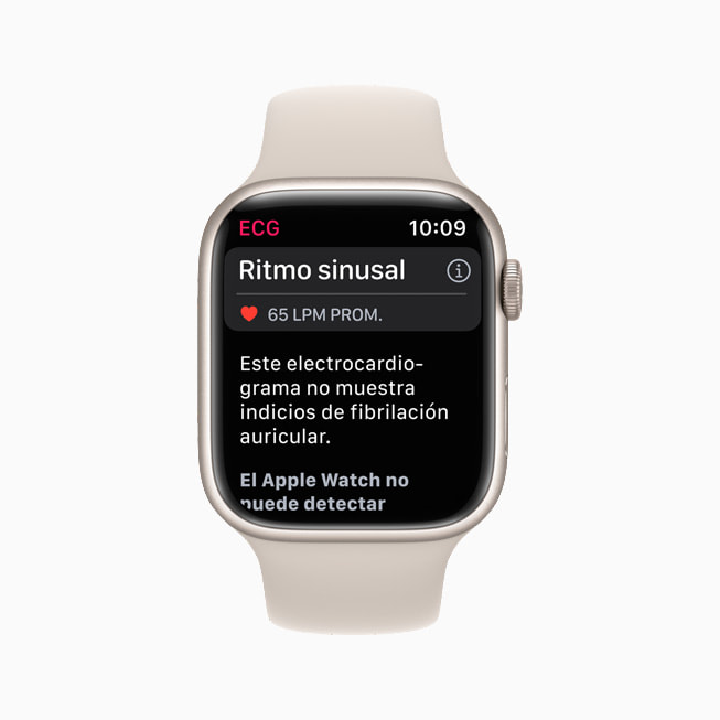 Se muestra la clasificación del ritmo sinusal en la app ECG en un Apple Watch Series 7.