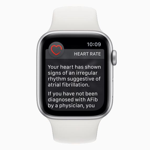 The heart rate notification screen displayed on Apple Watch.