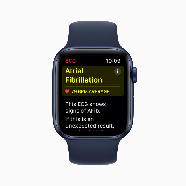 The heart-rate notification screen displayed on Apple Watch Series 6.