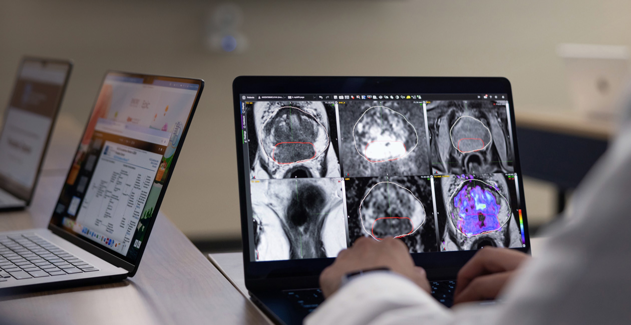 Un MacBook Pro muestra imágenes de radiología.