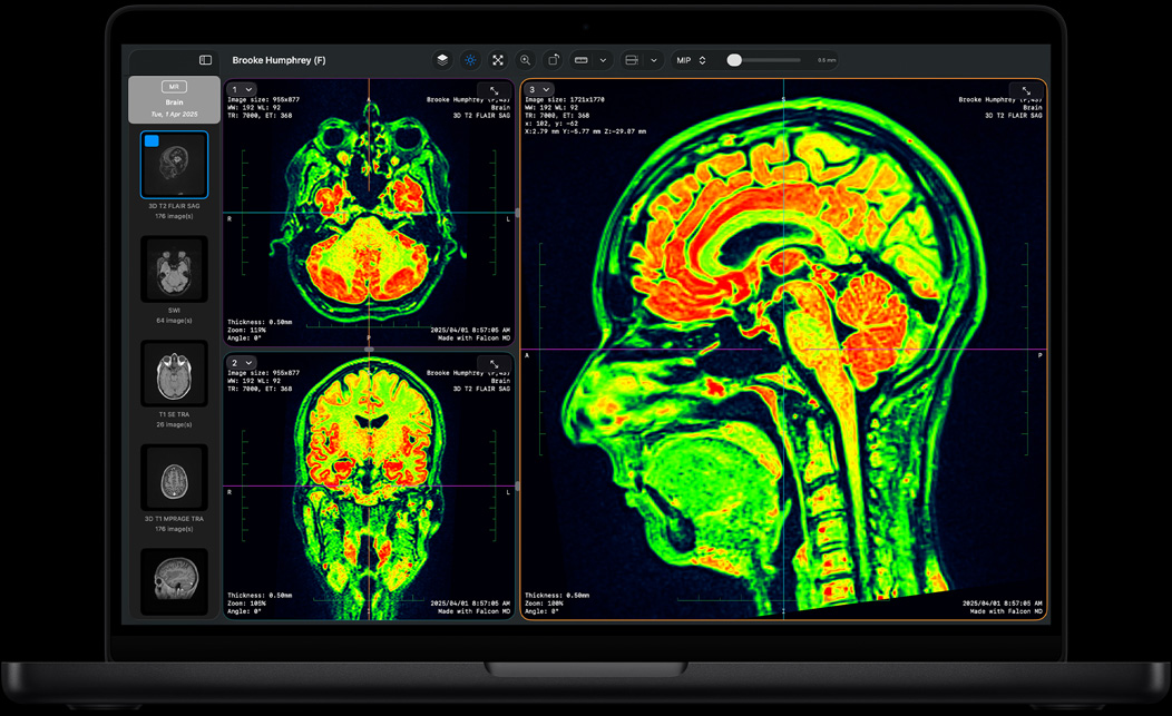Bildschirm eines MacBook Pro mit Falcon MD