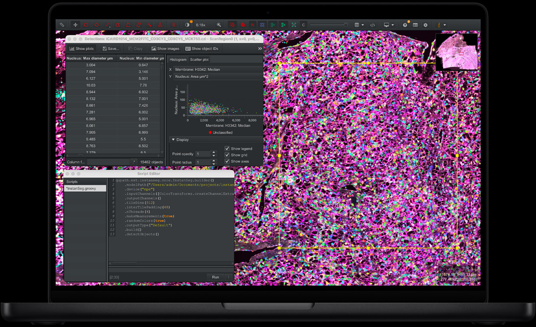 MacBook Pro, QuPath, fluorescent-stained tissue sample in pink, purple, and green, Script Editor panel with code, detections table showing nucleus diameter measurements, scatter plot chart
